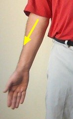 Figure 3. External Rotation of the Arm