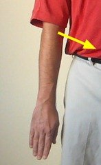 Figure 2. Internal Rotation of the Arm