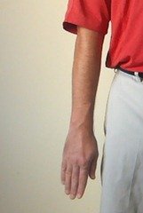 Figure 9. Pronated Wrist (also including internal rotation of the shoulder)