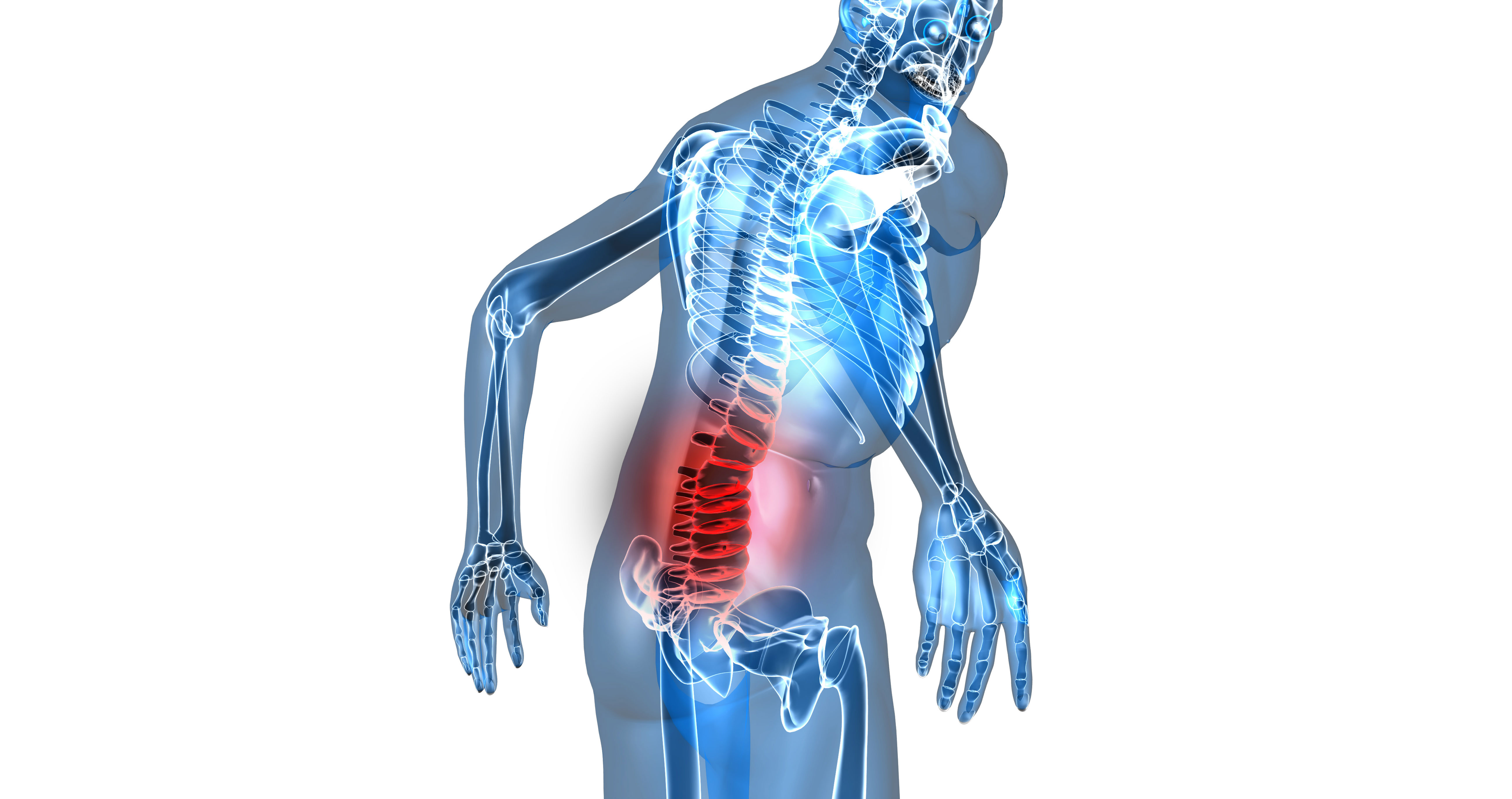 Is Back Pain Considered Muscle Pain