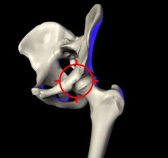 Hip joint